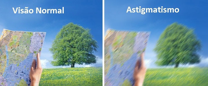 O astigmatismo o que causa?